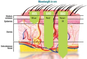 Different layers of the skin