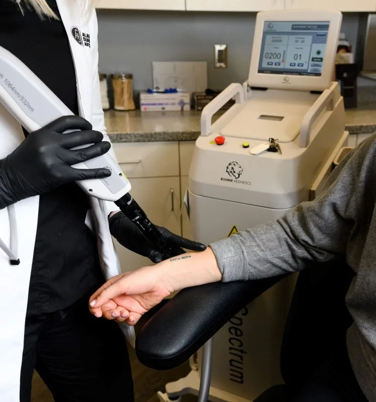 Patient receiving a tattoo removal