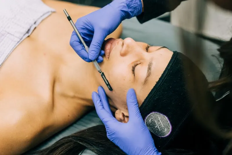 Woman receiving Dermaplaning treatment
