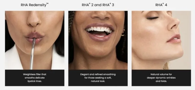 Areas are Typically Treated with Dermal Fillers