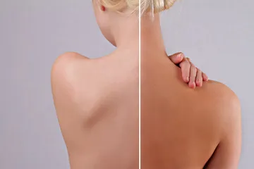 before and after spray tan