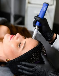 Microneedling